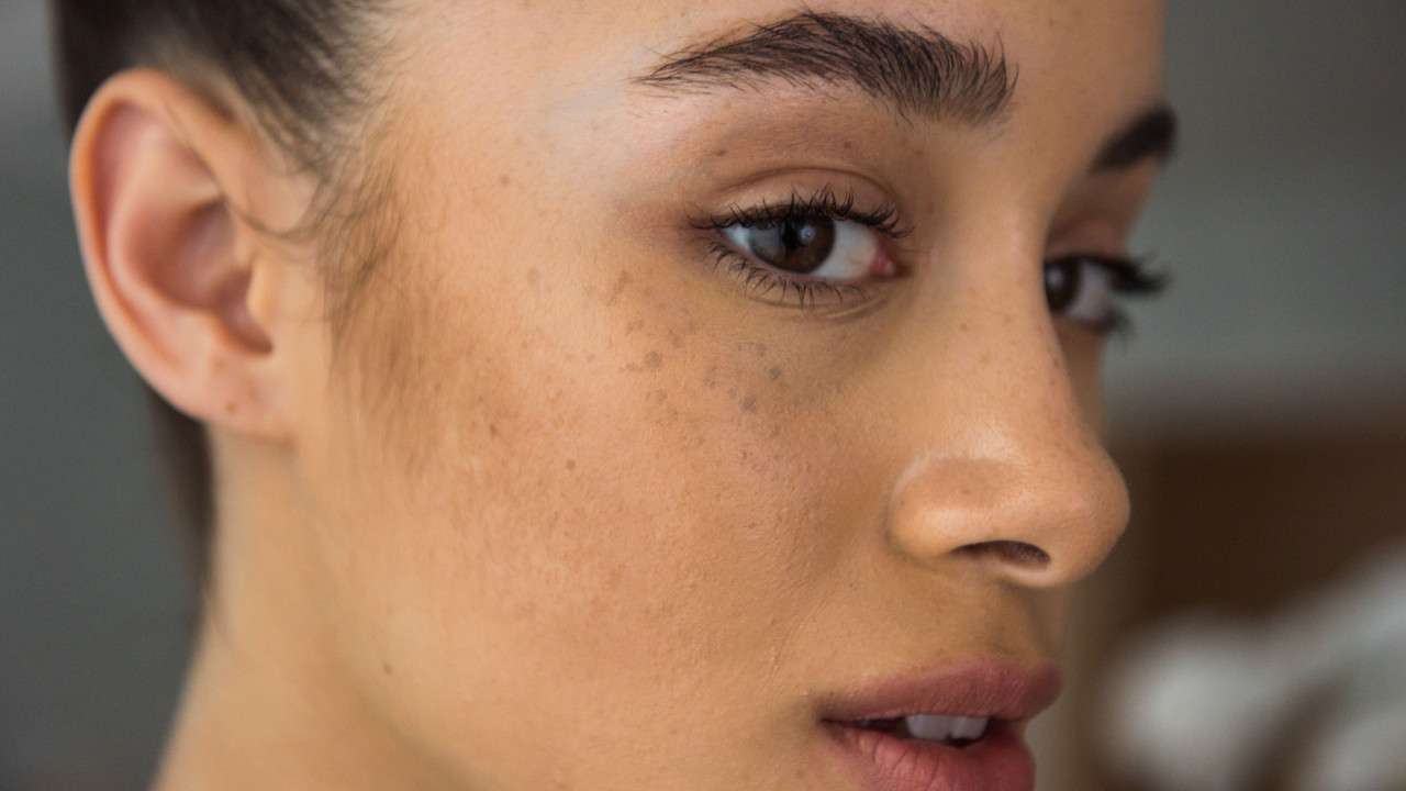 خطورة إزالة الشعر بالليزر للنساء
