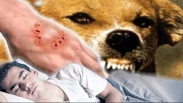 تفسير حلم عض الكلاب في اليد اليمنى
