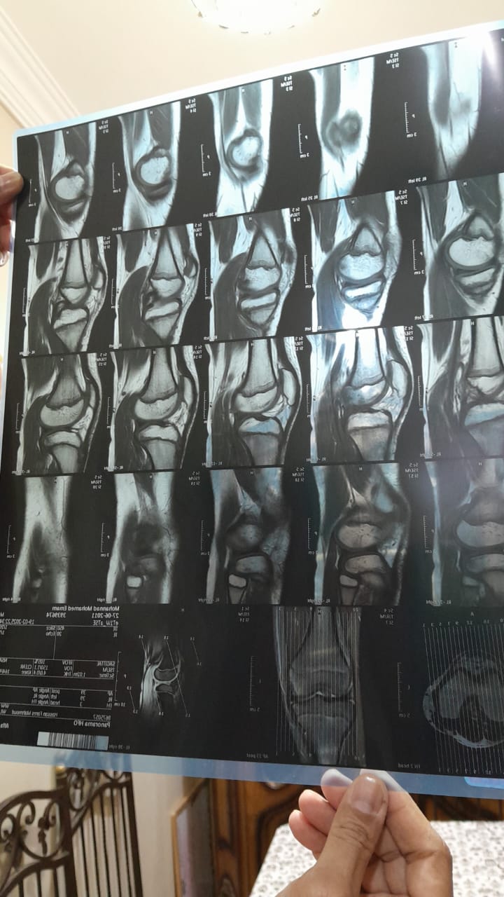 صورة اشعة الطفل