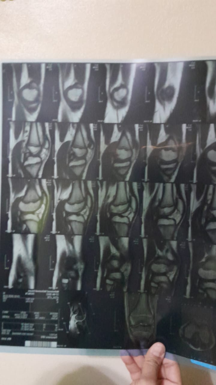 صورة أشعة الطفل