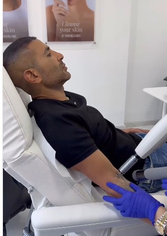 أحمد سعد يبدأ مرحلة ازالة الوشم &nbsp;ويُعلق: من أحسن القرارات اللي أخدتها