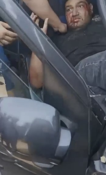 إصابة شخصين في حادث تصادم ملاكي بالتجمع&nbsp;