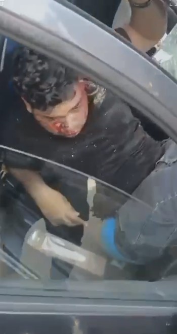 إصابة شخصين في حادث تصادم ملاكي بالتجمع&nbsp;