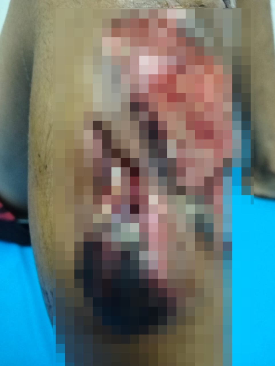 &nbsp;كلب شرس يعقر صغير في فخذه بالسلام&nbsp;