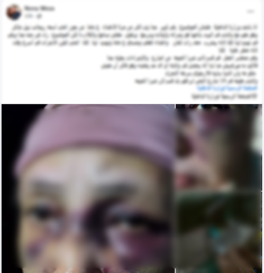 التعدي على مسنة بالقليوبية&nbsp;