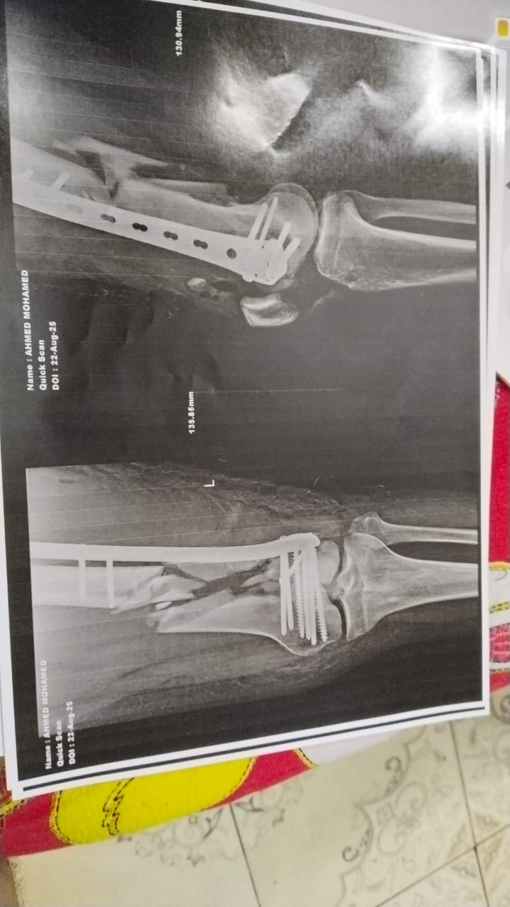 تقرير طبي لأحد مصابي حادث أسيوط&nbsp;