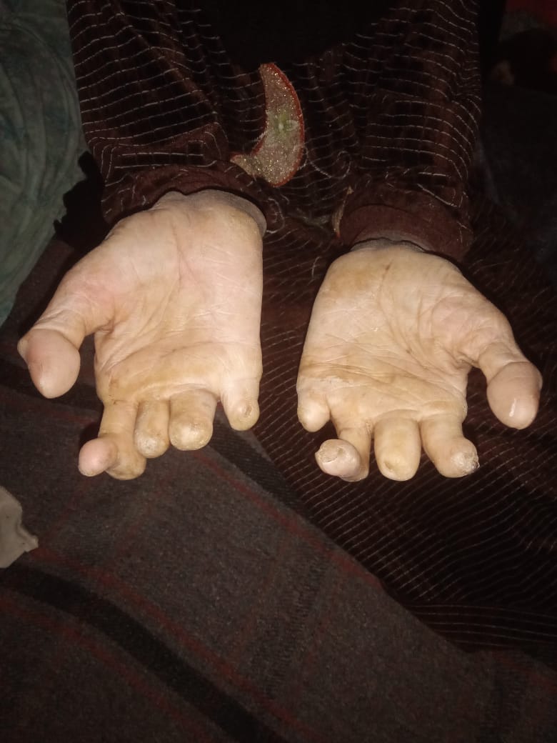 حالة المريضة