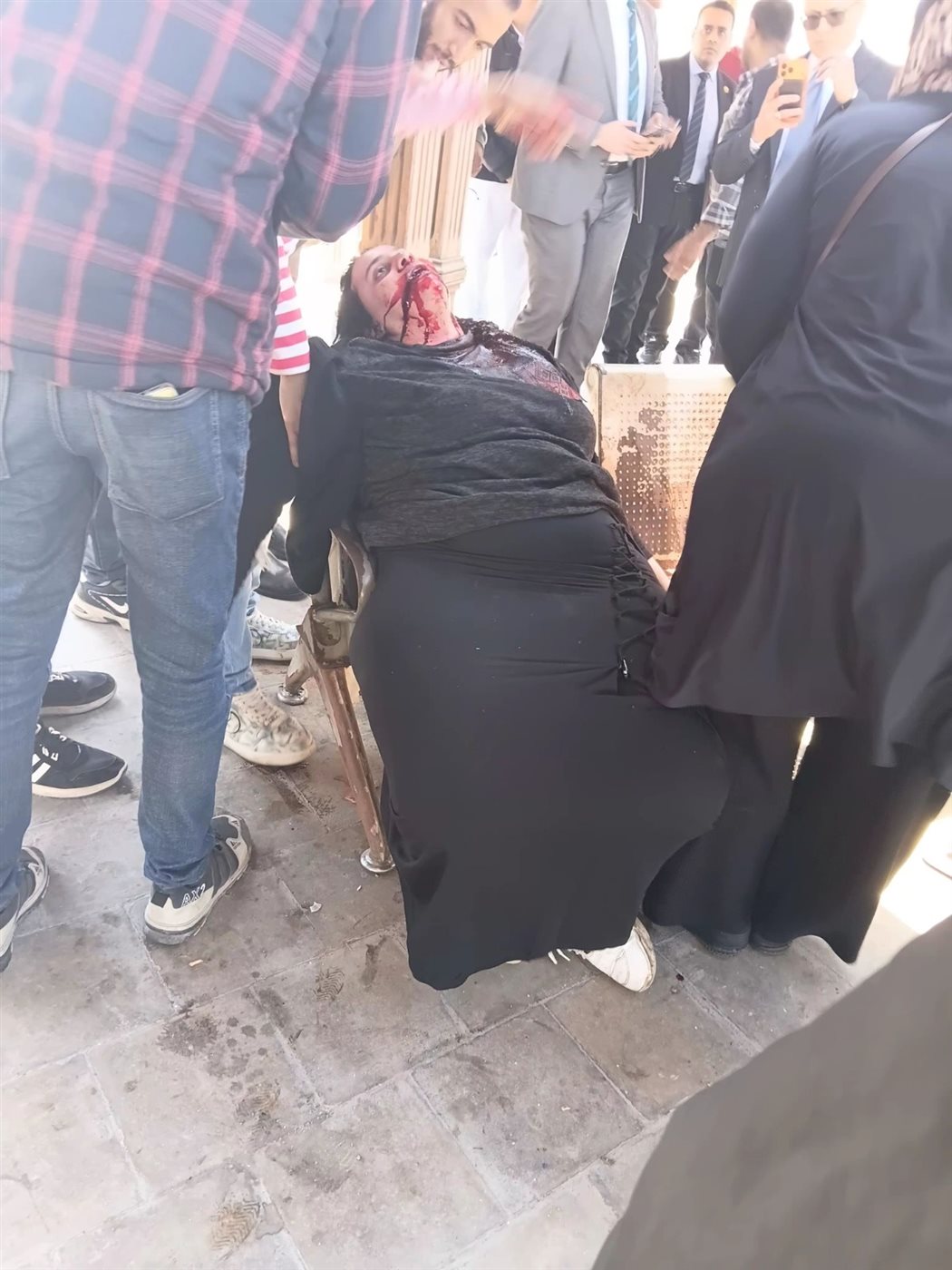 إصابة سيدة&nbsp;