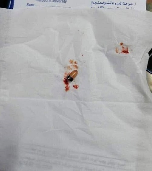 استخراج سماعة غش من أذن طالب