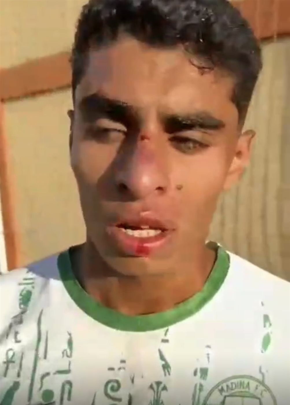 الاعتداء على اللاعبين&nbsp;