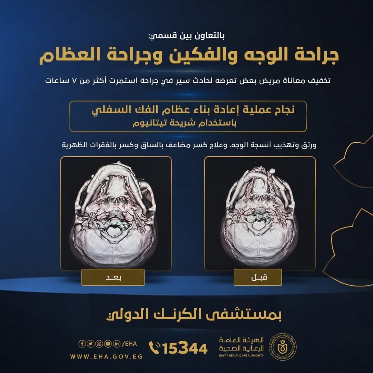 جراحة ناجحة لإعادة فكّ بالأقصر