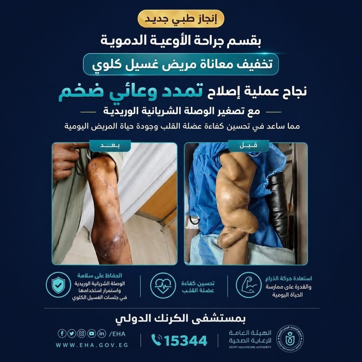 إنقاذ قلب مريض غسيل كلوي بمستشفى الكرنك&nbsp;
