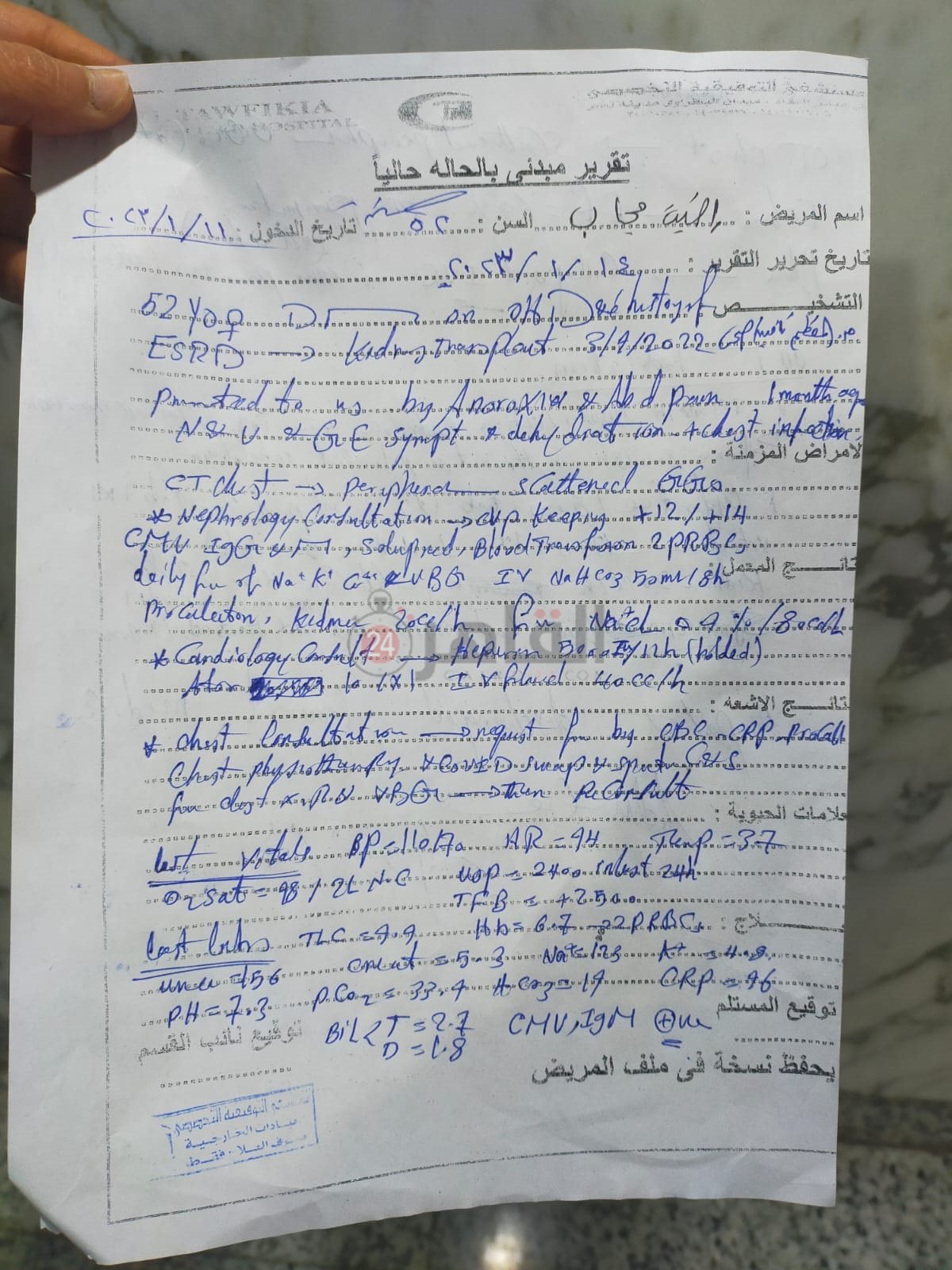 زراعة كلى 2