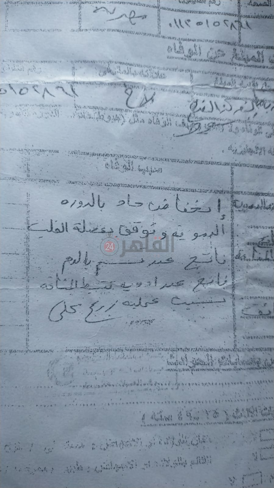 زراعة كلى