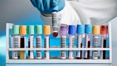 5 فحوصات طبية ضرورية لكل فتاة.. تعرفي عليها