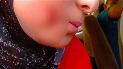 التحقيق مع مرتكب جريمة التعدي علي طالبة بالمرج وإحداث عاهة بالوجة