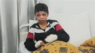 خدوني عندكم علشان أطيب.. الطفل الفلسطيني علي مشتهى يتمنى العلاج بمصر | خاص 