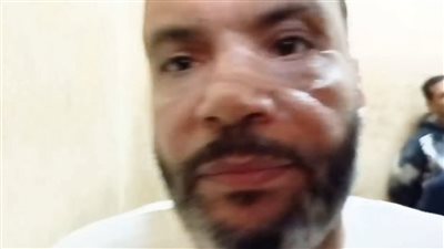 صيدلي مدينة نصر ينفي اتهامات زوجته: اتجوزتها مكنتش بكر وعايزة تدمرني وتاخد ممتلكاتي| بث مباشر 