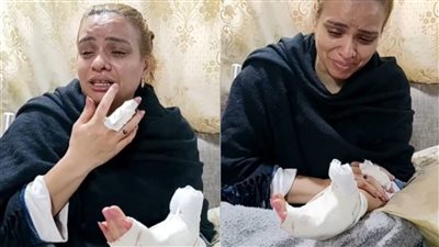 فود بلوجر تتهم يوتيوبر شهير بالتعدي عليها: عورني 17 غرزة ونشرلي فيديوهات مخلة| فيديو 