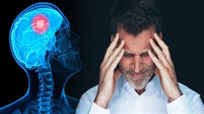 مرض يتسبب في حدوث السكتة الدماغية.. تعرف عليه 