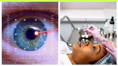 أخطر جراحات التجميل.. جراحة تغيير لون العين تتصدر القائمة بنسبة مضاعفات تصل إلى 92%