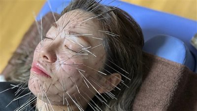 تصدرت التريند.. ما هي العيادة اليابانية التي تجمع بين العلاج الجسدي الروحي ووخز الإبر؟