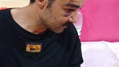 جهات التحقيق في السويس تستمع لأقوال صاحب محل قطع غيار بعد الاعتداء عليه