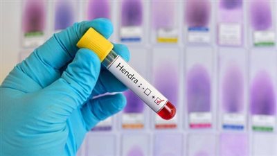 اختفاء عينات 3 فيروسات من مختبر في أستراليا.. والسلطات تحقق