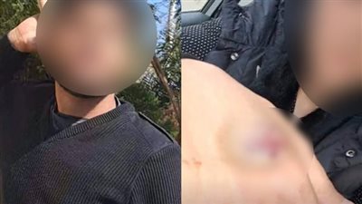 اليوم.. نظر استئناف حبس المتهمين بالتعدي على طبيبة الشيخ زايد لطردها من منزل زوجها