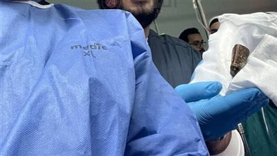 نجاح عملية استخراج 3 بطاريات من جوف مريض بالمنوفية| بث مباشر