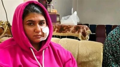 شاب يشوه وجه خطيبته السابقة بسلاح أبيض ويروعها بكلب شرس في الشرقية