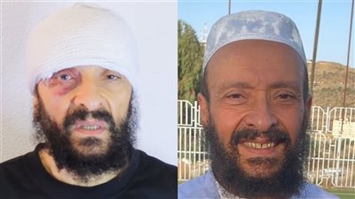 لازم عيالي يعتذروا.. الطبيب المصري المقيم بالسعودية يكشف تفاصيل جديدة حول واقعة اختلاس أبنائه لأمواله 