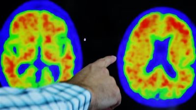 لتقليص قوائم الانتظار.. جدل بريطاني بعد تأجيل 25% من المرضى في المستشفيات