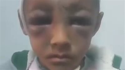 بسبب 3 سجائر بـ 10 جنيهات.. أب يعتدي بالضرب على نجله ويطعنه بسكين في المحلة