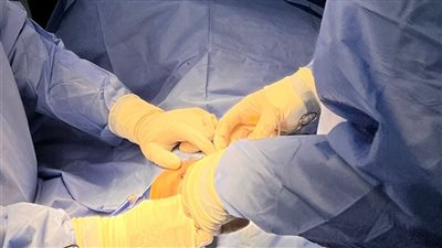 نجاح عملية جراحية عاجلة لإنقاذ رضيع حديث الولادة بمستشفى طلخا المركزي في الدقهلية