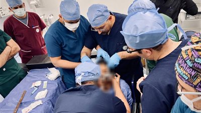 الرعاية الصحية تعلن نجاح أول عملية زرع مضخة باكلوفين لعلاج التشنج العضلي الشديد لمريض بالأقصر