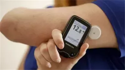 مصدر: الصحة تطلق مبادرة لتوفير أجهزة قياس السكر دون وخز لـ5 آلاف صغير.. والبداية بـ1100 طفل للعام الجاري