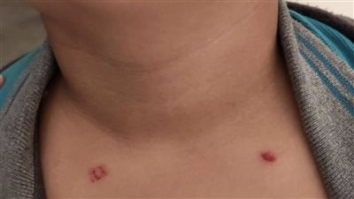 ألفاظه غير لائقه واعتدى على زميله.. أول رد من مدرسة طالب تعرض للتنمر والضرب