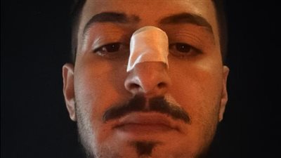 بعد نشر القاهرة 24.. ضبط المتهمين بالتعدي على شاب في واقعة زفة عريس بطريق وصلة دهشور