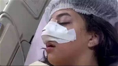 مشاجرة مدرسة كابيتال.. عرض الطالبة كارما على لجنة ثلاثية من الطب الشرعي لحسم وجود عاهة مستديمة