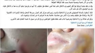القبض على طالب لاتهامه بالاعتداء على طفل بزجاجة في البحيرة 