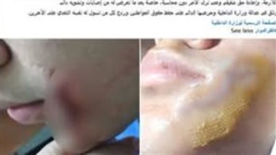 القبض على طالب تعدى على زميله بقطعة زجاج بالبحيرة