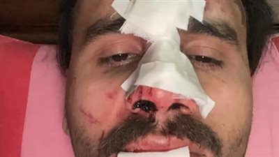 إصابة محمد صالح أحد فريق 