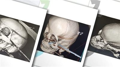 استخراج 