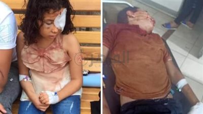 النيابة تستمع لأقوال الأطفال المصابين بحفل زفاف بالخانكة وتحيلهم للطب الشرعي