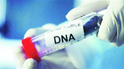 حكم الاعتماد على تحليل DNA لإثبات الزنا ونفي النسب
