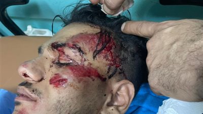 تفاصيل وصور  حادث حودة بندق على الطريق الدائرى خلال ذهابه لإحياء حفل زفاف 