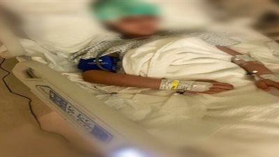 طفلة تذهب إلى مستشفى طنطا لإزالة كيس دهني وتدخل في غيبوبة بسبب الإهمال الطبي.. وأسرتها: حالتها صعبة جدا