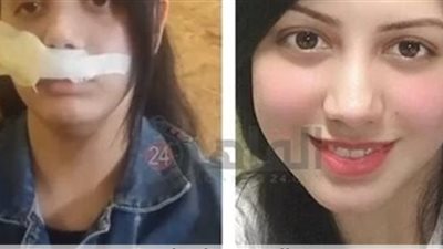 إحالة المتهم في واقعة التعدي على طليقته إلى محكمة جنايات الجيزة