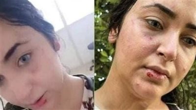 من ضحية الحجاب لعضوية الجماعة إرهابية.. القصة الكاملة لـ إيزيس صيدلانية الشرقية